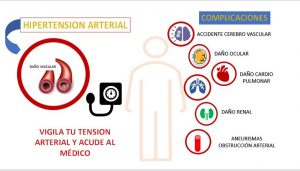 hipertension arterial ilustracion